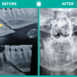 face and jaw fractures