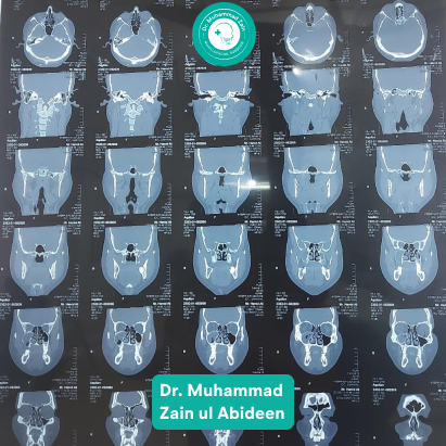 Jaw alignment