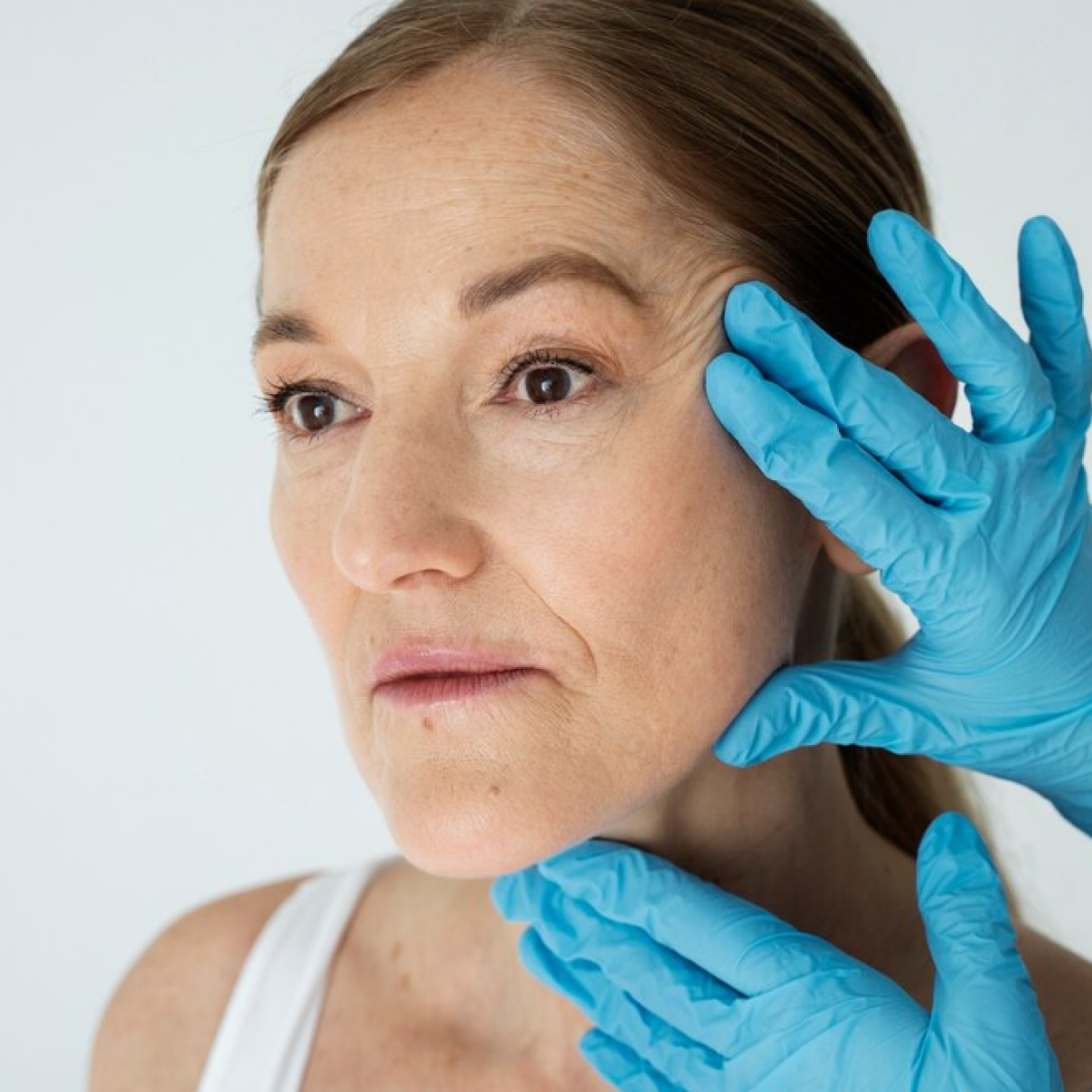 Thread lifting for the face and neck