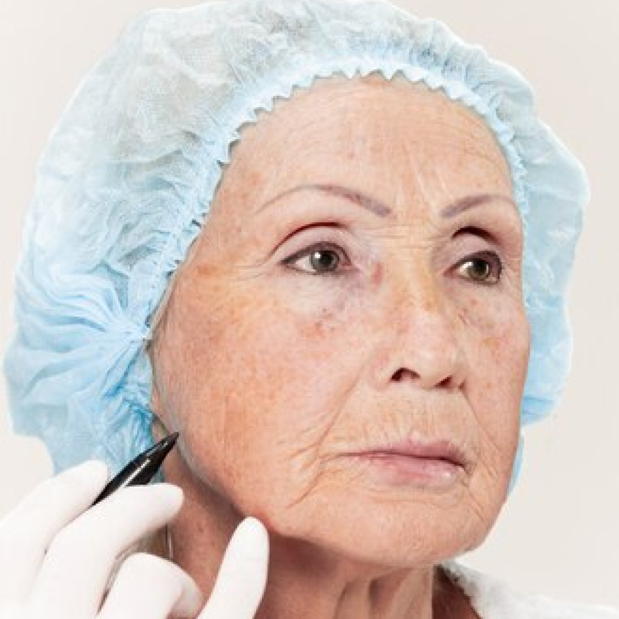 Botox anti-aging treatment for facial wrinkles