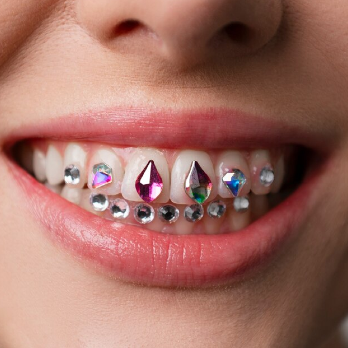Teeth jewelry
