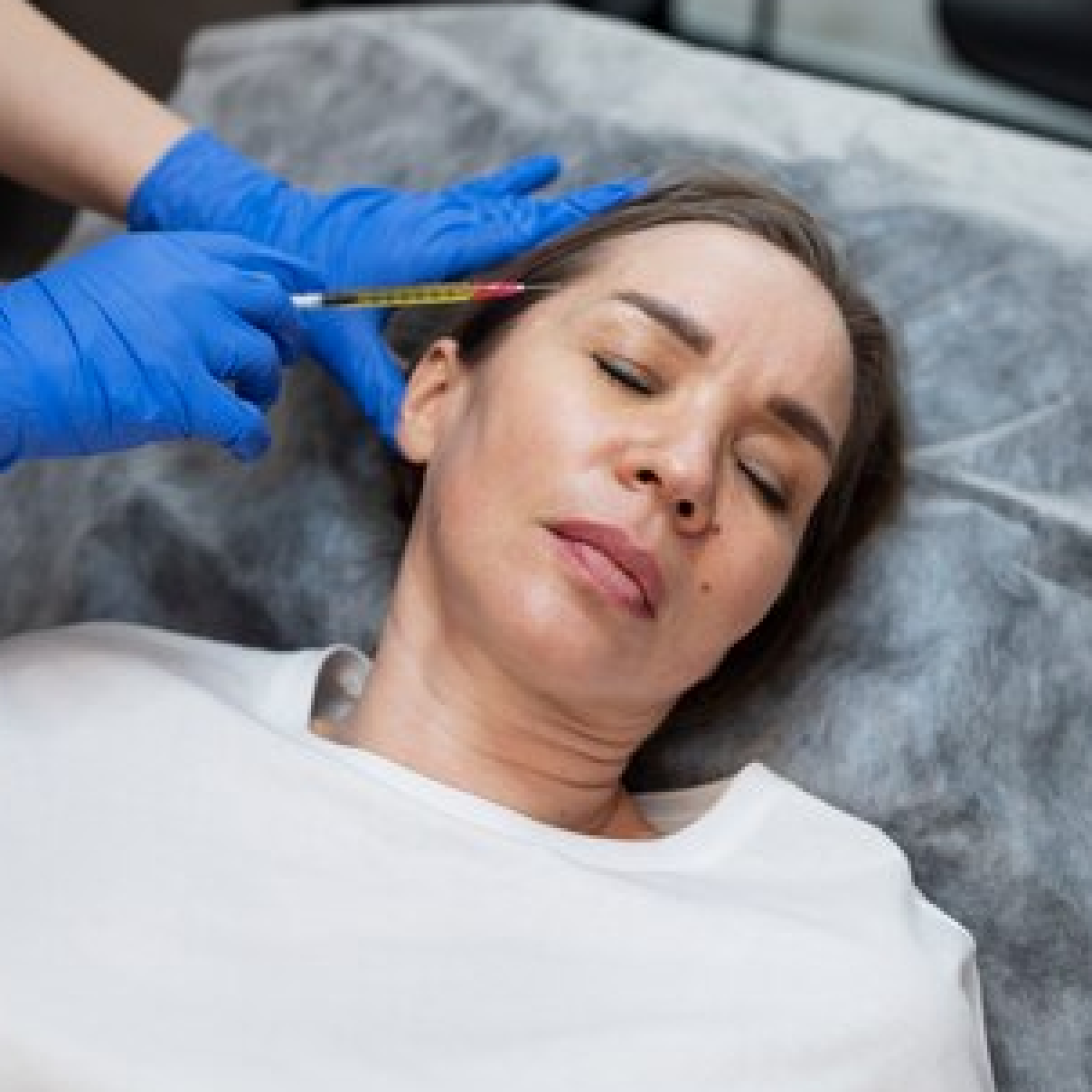 PRP phases and micronutrient mesotherapy