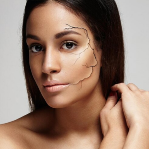 Scar removal surgery